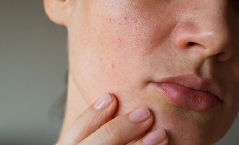 Hard Water Buildup Problems and Solutions